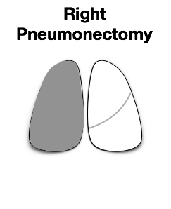 Lung3